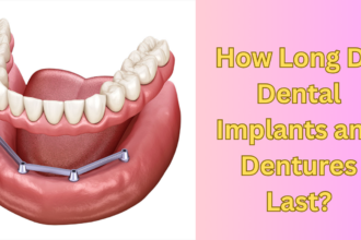 How Long Do Dental Implants and Dentures Last?