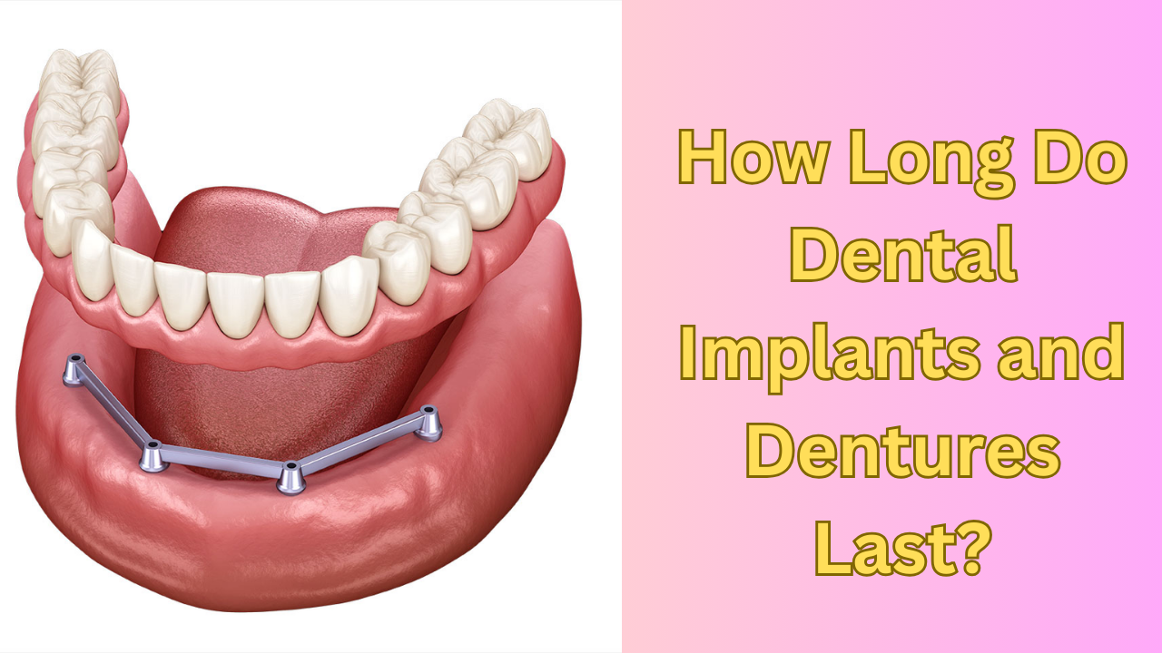 How Long Do Dental Implants and Dentures Last?