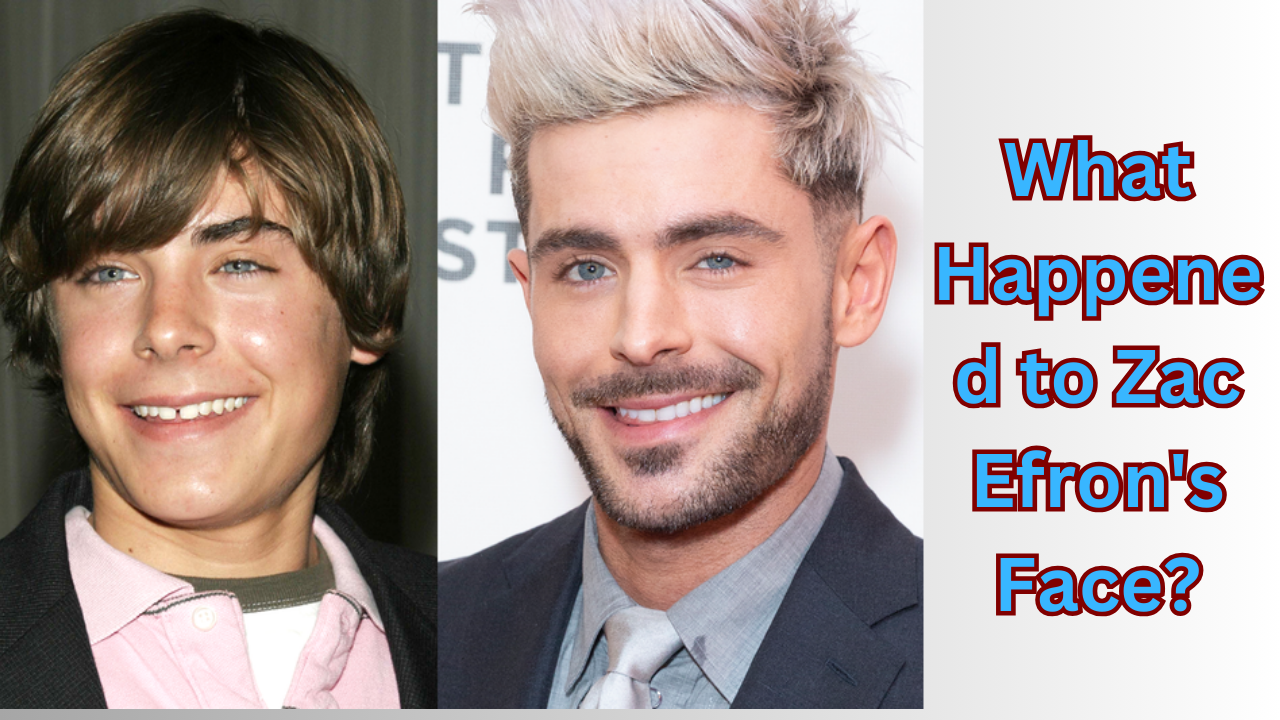 What Happened to Zac Efron's Face?
